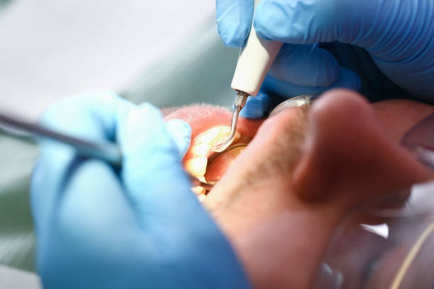 Best Emergency Dental Care for Broken or Chipped Teeth in Ingram, PA